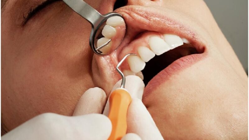 Teeth straightening dilemmas and how to solve them