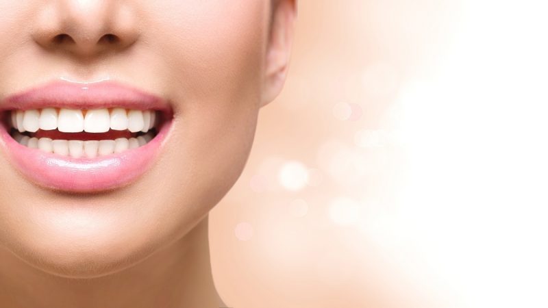 A beginner’s guide to Incognito teeth braces in Weybridge