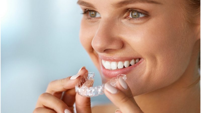 How to discreetly straighten teeth brace