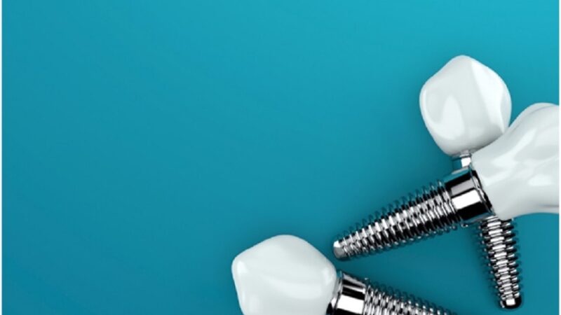 oral implant